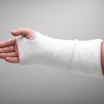 Fracture Care